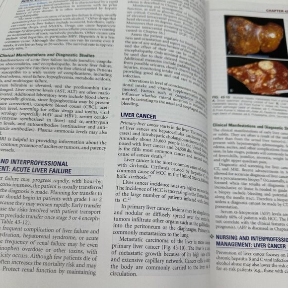 Medical Surgical Nursing Vol 2 10th Edition Textbook Lewis Bucher Harding - Picture 10 of 12